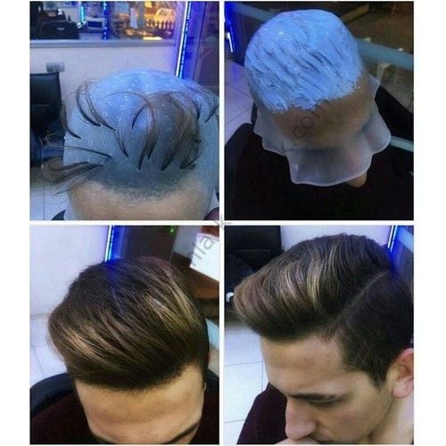 Delikli meç bone röfle bonesi es 404 tığsız